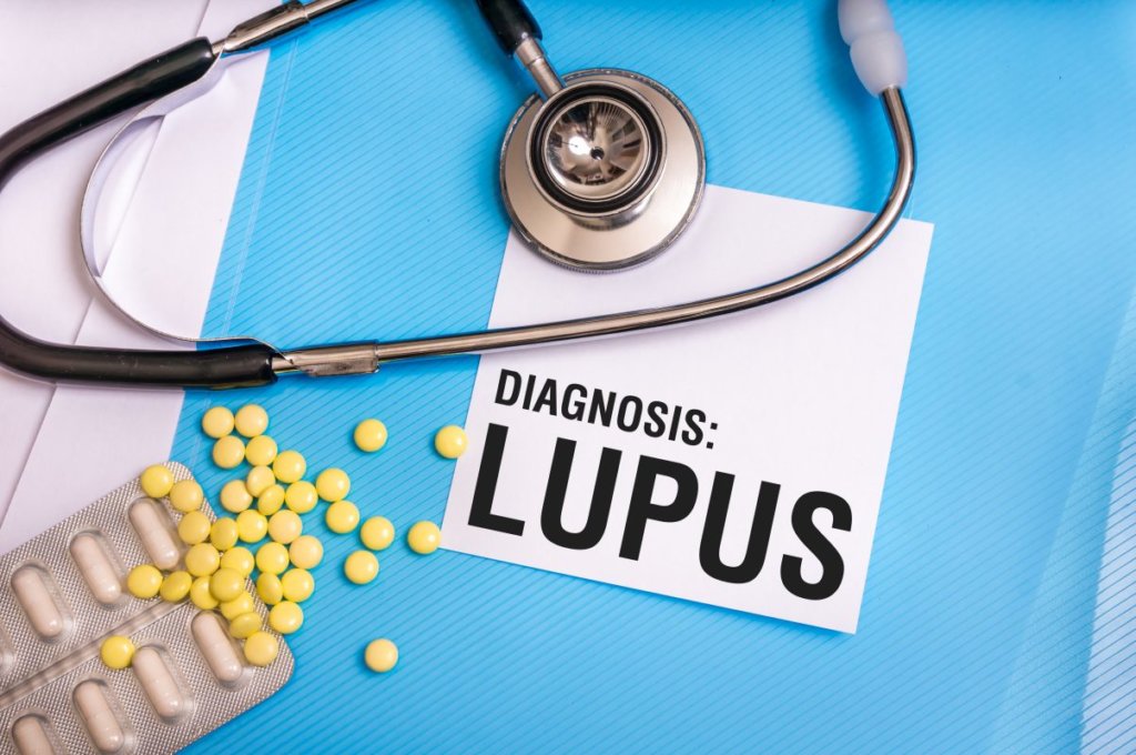Gut Bacteria Imbalance Linked To Lupus