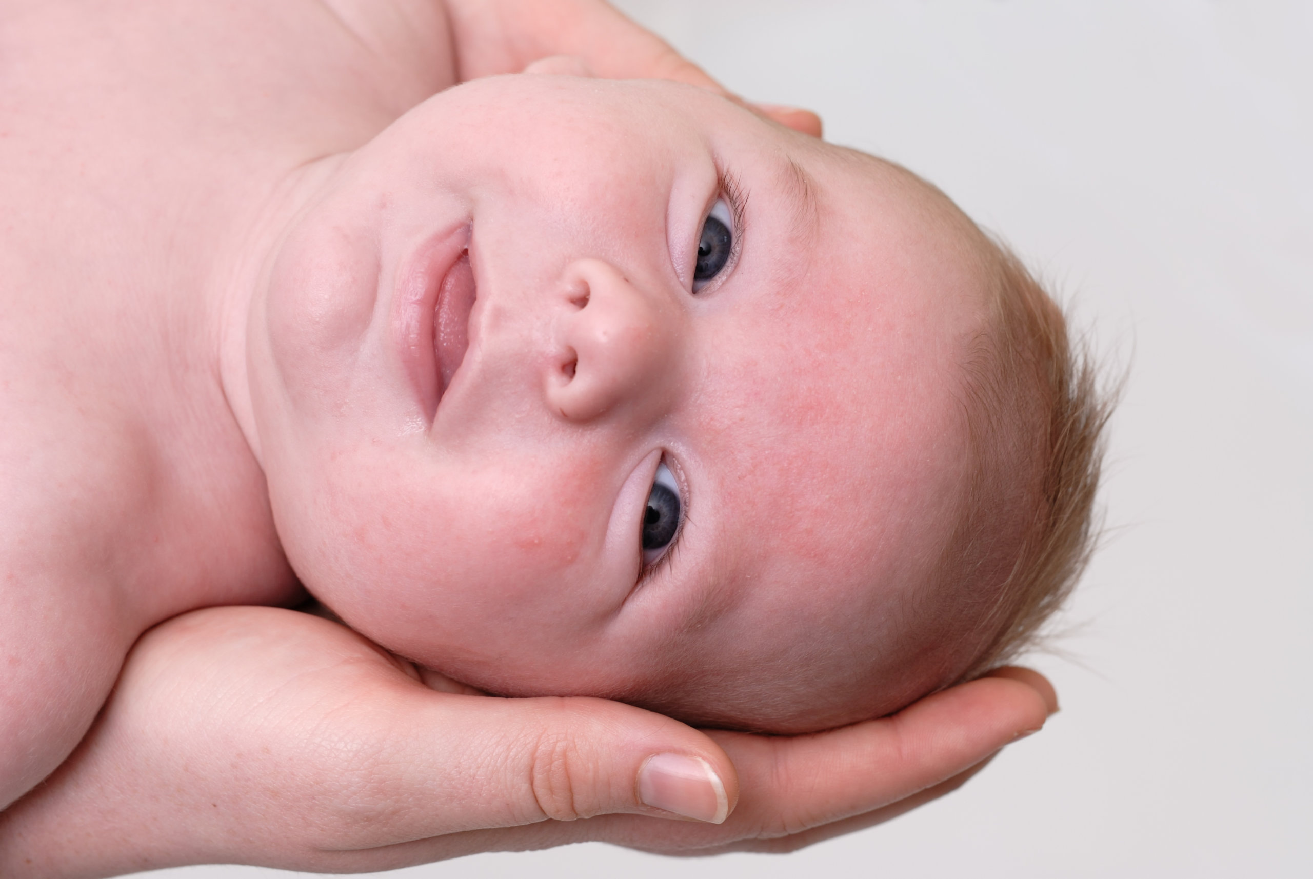 baby having a bit of exema and redness on his face