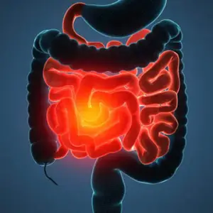 Gut Guide - Crohns