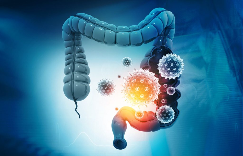 Gut Microbiome Impacts Severity of COVID-19