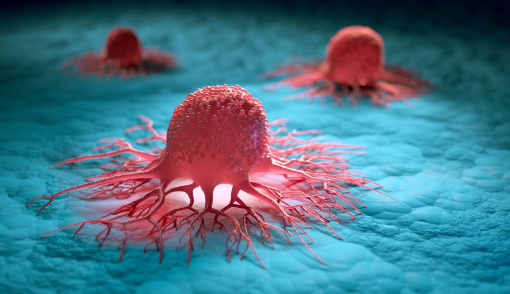 Half of Cancer Deaths Linked to Preventable Risk Factors